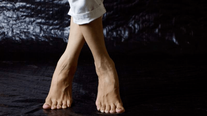 deformity