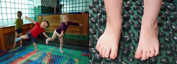 Valgus deformity gymnastics
