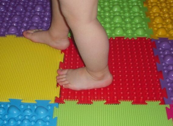 Preventing Valgus Pathology